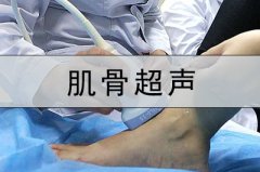 超聲檢查新領域肌骨超聲